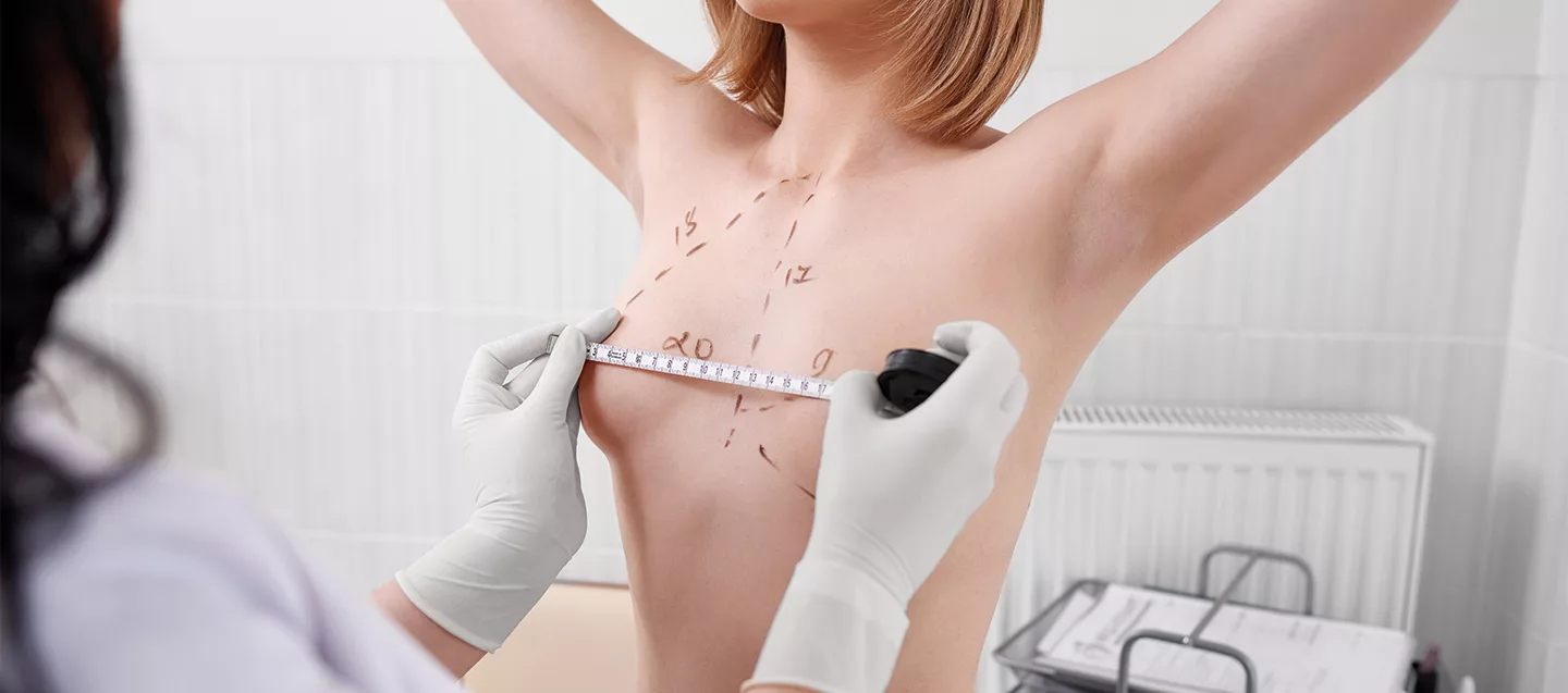 Breast Augmentation